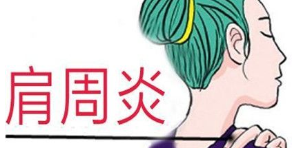 不良習(xí)慣為肩周炎埋下伏筆？玄鹿中頻治療儀