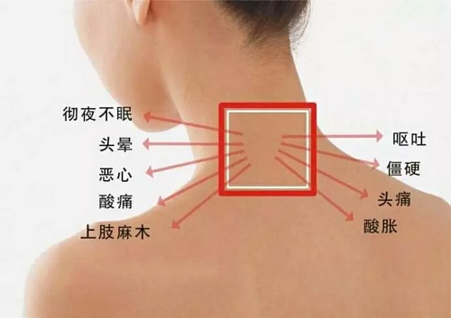 你的頸椎還健康嗎？