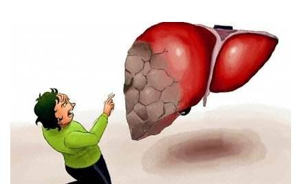 頭部出現(xiàn)這4種狀況，就要注意你的肝了！